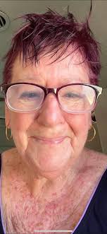 Living in Toronto, Ontario, Canada