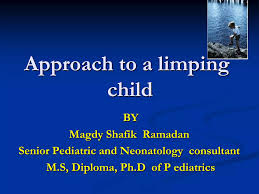 Image result for Pediatric Limp
