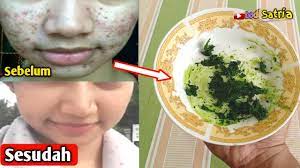 Foto yang digunakan untuk memelet wanita tersebut bisa bebas, bisa diambil dari mana saja, bisa diambil dari social media, dari blognya dia, dari bbm dan sebagainya. Lakukan 1 Hari 1 Kali Maka Kualitas Suara Jadi Merdu Dan Jernih Seperti Judika Youtube