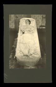 Marie Curie died because she was exposed to too much radiation in 1934. Her  body is still radioactive, so it was placed in a lead-lined coffin.