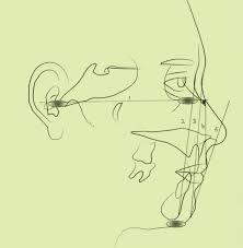 Word italian word japanese word korean word latin word malay word malayalam word marathi word nepali word norwegian word polish word portuguese word romanian word. Scielo Brasil Soft Tissue Cephalometric Measurements Among Malaysian Malays And Chinese Soft Tissue Cephalometric Measurements Among Malaysian Malays And Chinese