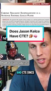Jason Kelce Head Injury