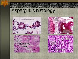 Important species include aspergillus fumigatus, niger, flavus, calavtus; Ppt Fungi Powerpoint Presentation Free Download Id 259659