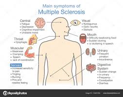 main symptoms of multiple sclerosis stock vector