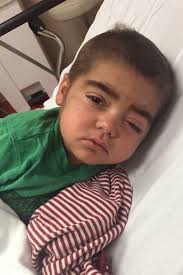 Everyone that will please pray for Lil Austin So Austin's eye wasn't  getting better so I took him to the doctor and I'm glad I did. He doesn't  have a stye. Austin