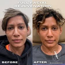 Photos by The Nice Needle Nurse