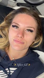 Two week retention and volume fill