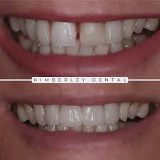 Cosmetic Dentistry - Kimberleydental.co.uk