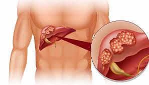 Image result for Liver Function Test