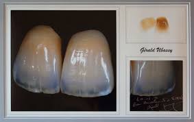 Abel-Chappell Zahntechnik