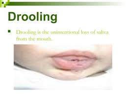 نتیجه جستجوی لغت [drooling] در گوگل
