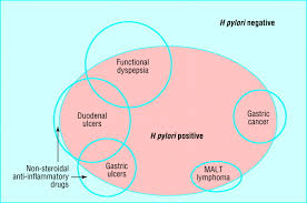 Pathophysiology Of Duodenal And Gastric Ulcer And Gastric Cancer The Bmj