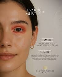 ▫️ Sometimes along the loss of the visual function, there maybe  disfigurement in the eye which holds a psychological burden. ▫️ A surgical  intervention was first performed to restore the natural eye