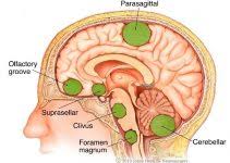 That said, that a positive personality change is possible, shows that the story of what can happen after brain injury is more complex and surprising than many. Can Your Personality Change After Brain Surgery Brain Surgery Com