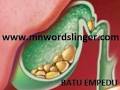 Hasil gambar untuk Obat Herbal Batu Empedu