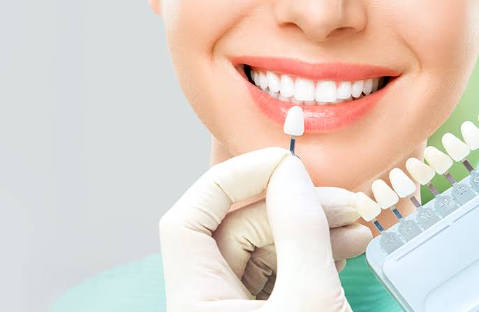 Cosmetic Dentistry Oceanside | Grace Dental