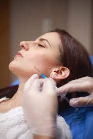 Rejuvenecimiento Facial sin Cirugía con el Dr. Dario Felipe Cabello