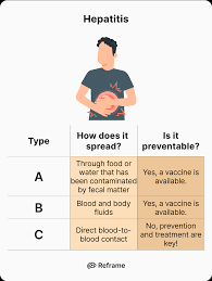 Image result for hepatitis symptoms