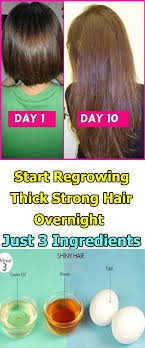 Either you shell out for removable fake hair, or you undertake the painstaking process of growing your own out. Start Regrowing Thick Strong Hair Overnight With Just 3 Ingredients Hair Remedies For Growth Hair Growth Faster Grow Long Hair