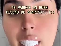 What are good dentists in Brownsville or Harlingen area for implants or  crowns?