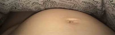 Tummy Bulging 1 Side Normal