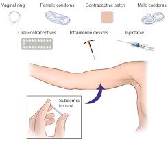It also may depend on when you last had sex, and what you used for protection. How Long Does It Take To Get Pregnant After Stopping A Contraceptive Method