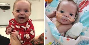Heart hero, Theo, has been through more than most children his age, but  that hasn't stopped him smiling! In May 2017, Theo was born with a number  of heart defects. He had