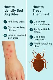 Image result for bedbugs bites