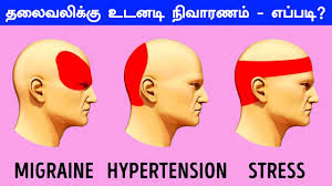 Most people who suffer from like migraines, cluster headaches typically occur on one side of the head and occur in clusters as their name suggests. à®¤ à®° à®¤ à®¤à®² à®µà®² à®• à®• à®‰à®Ÿà®©à®Ÿ à®¤ à®° à®µ à®• à®Ÿ à®• à®• à®® Get Rid Of Headache Immediately Tamil Bells Youtube