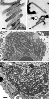 Marburg is a rare, severe form of hemorrhagic fever closely related to the ebola virus. Negative Stain Images Of Marburg Virus A And Ebola Virus B Download Scientific Diagram