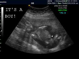 We at baby ultrasound co use new cutting edge ultrasound technology to bring images of your baby to life. Second Guessing The Ultrasound Babycenter