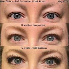 Instead, it calls itself a here's what you need to know about lash serums, their ingredients, and how they work. After Chemo Dina Started Using Lash Boost On Her Lashes And Brows Impressive Right Randf Lashboost 6 Lash Boost Rodan Fields Lash Boost Rodan And Fields