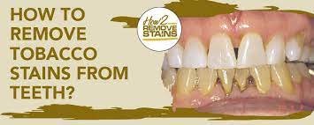 By diluting a small amount of hydrogen peroxide in a bottle of water, take a drink, whip it through your oral cavity for a few seconds, and then spit it out. How To Remove Tobacco Stains From Teeth Detailed Answer