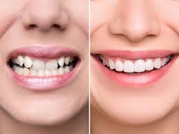 In case we have missed out on other great inspirational and motivational movies based on true stories or events, feel free to let us know in the comments. The Dentistry Company Causing Smiles To Turn Into Frowns The Independent The Independent