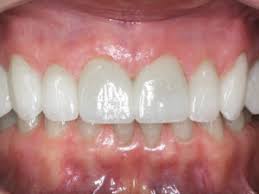 Her work is regularly featured in media such as first for w. Healthy Gums And Dental Care Dental Clinic Springfield Va