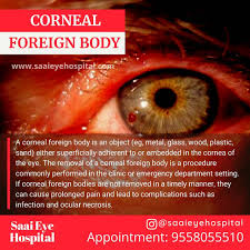 Image result for Eye Foreign Body
