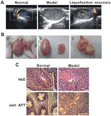 About 80% of these have an isochromosome 12p (the. Increased Efficiency Of Testicular Tumor Chemotherapy By Ultrasound Microbubble Mediated Targeted Transfection Of Simdr1