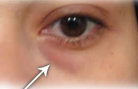 Comment Preparer Un Anti Cernes Naturel Quebec Echantillons Gratuits Cernes Soins Des Yeux Anti Cerne Naturel