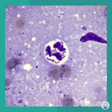 Image result for Intracellular Bacteria
