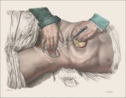 The nineteenth century saw a complete transformation of the practice and reputation of surgery. Crucial Interventions Between Survival And Wholeness The Lancet
