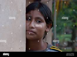 Sandy Bay, Nicaragua. 03-15-2019. Close up of an female adolescent having  her face supported
