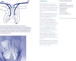 Image result for Elson Extensor Tendon Test