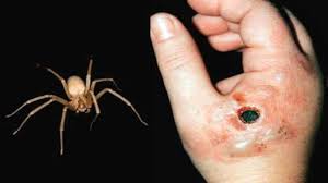 Características de la araña violinista. Arana Violinista Mortal Para El Ser Humano Ya Esta Presente En Todo Mexico