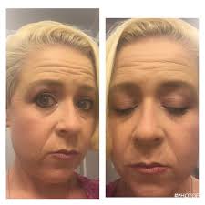 Erin Caputo (caputo0563)