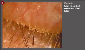 Image result for Blepharis affinis