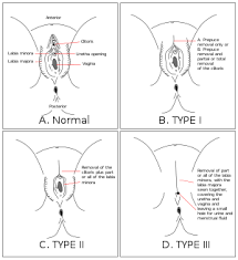 Test empirico di funzionamento del sensore. Female Genital Mutilation Wikipedia