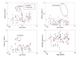 One stop hub for all the courier services. Quantification Of Maternal Fetal Cardiac Couplings In Normal And Abnormal Pregnancies Applying High Resolution Joint Symbolic Dynamics