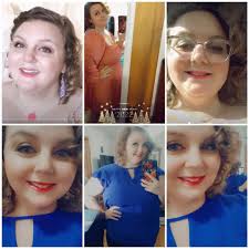 Starting bariatric surgery journey with approval