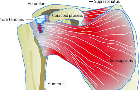 Anterior graphic of the shoulder. Diagram Of Shoulder Tendons Supraspinatus Muscle Wikipedia Koibana Info Rotator Cuff Tear Supraspinatus Muscle Shoulder Muscle Anatomy