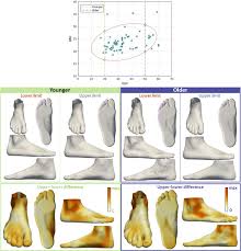 Check spelling or type a new query. Three Dimensional Quantitative Analysis Of Healthy Foot Shape A Proof Of Concept Study Springerlink